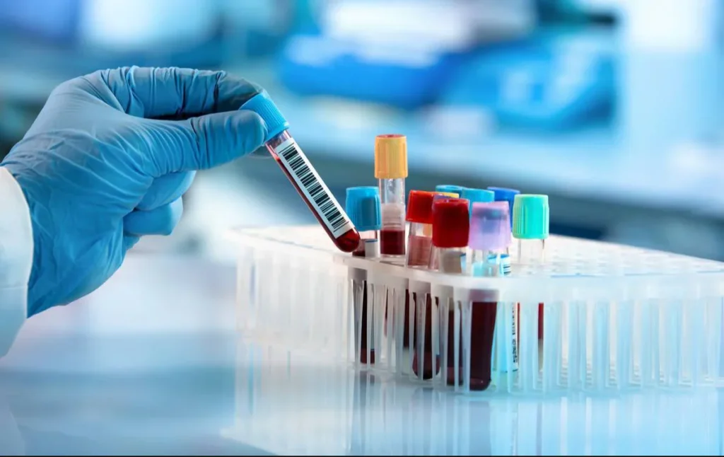 Laboratory blood sample collection process
