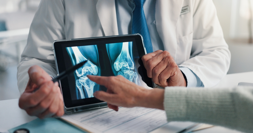 Doctor discussing knee X-rays with patient